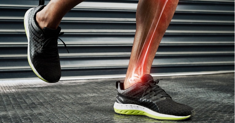 photo centrée sur les chaussures de running d'un sportif qui montre l'impact de la chaussure sur l'apparition des douleurs de périostite tibiale