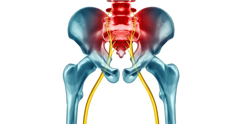 anatomie du nerf sciatique douleur lombaire causée par hernie discale