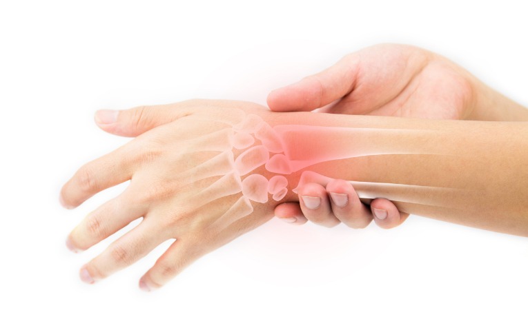 une femme maintient son poignet pour le protéger et le soulager de la douleur causée par sa fracture du poignet